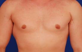 Patient Before & After Image