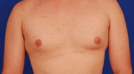 Patient Before & After Image