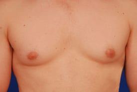 Patient Before & After Image