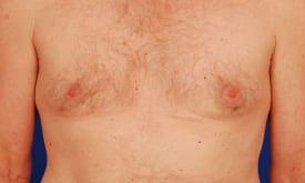 Patient Before & After Image