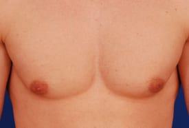 Patient Before & After Image