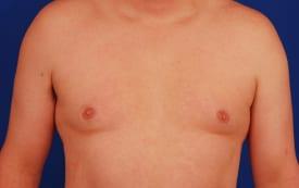 Patient Before & After Image