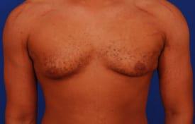 Patient Before & After Image