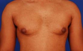 Patient Before & After Image