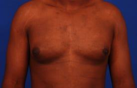 Patient Before & After Image