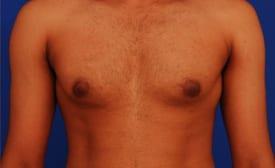 Patient Before & After Image