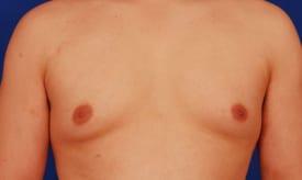 Patient Before & After Image