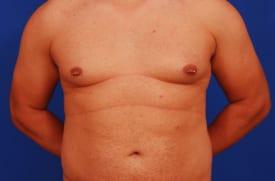 Patient Before & After Image