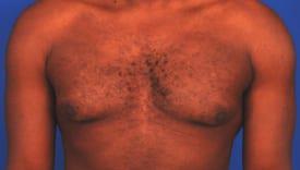 Patient Before & After Image