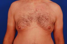 Patient Before & After Image