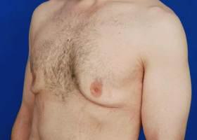 Patient Before & After Image