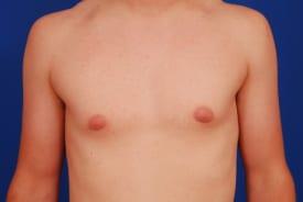 Patient Before & After Image