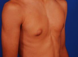 Patient Before & After Image