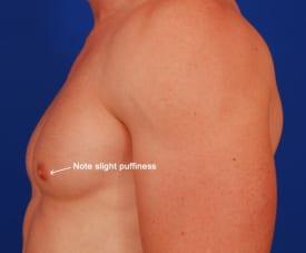 Patient Before & After Image