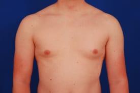 Patient Before & After Image