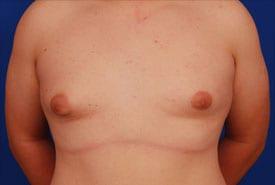 Patient Before & After Image