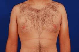 Patient Before & After Image