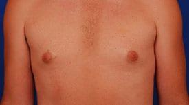 Patient Before & After Image