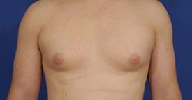 Patient Before & After Image