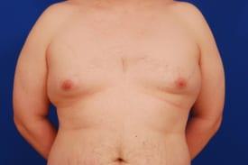 Patient Before & After Image