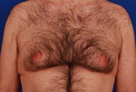 Patient Before & After Image