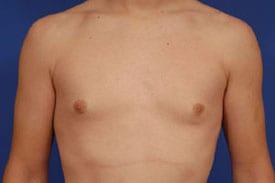 Patient Before & After Image