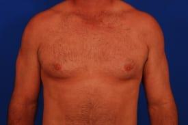 Patient Before & After Image