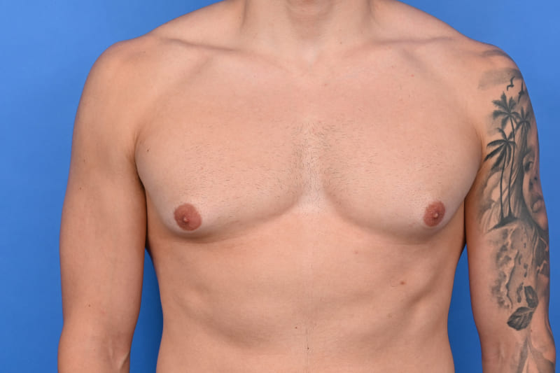 Patient Before & After Image