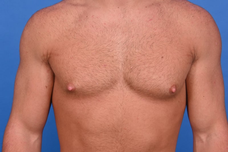 Patient Before & After Image