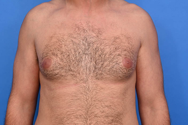 Patient Before & After Image