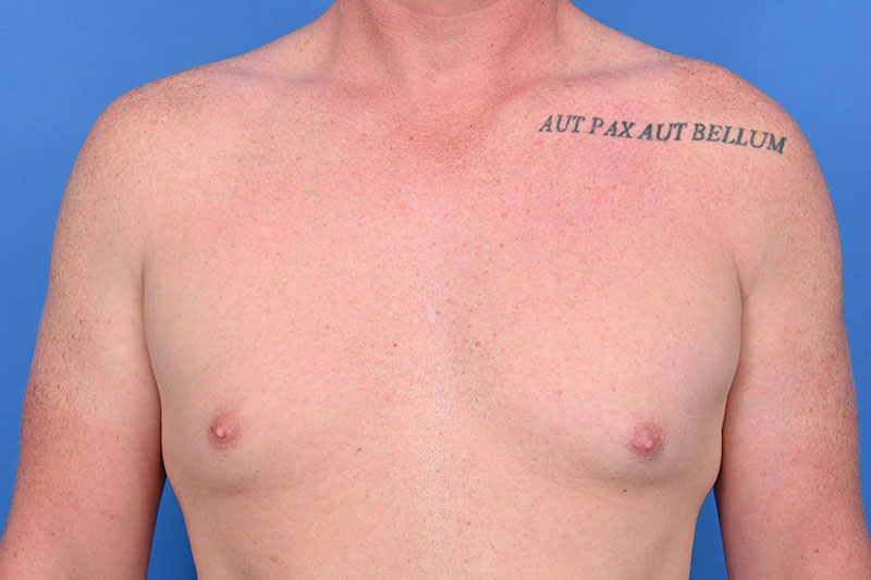 Patient Before & After Image