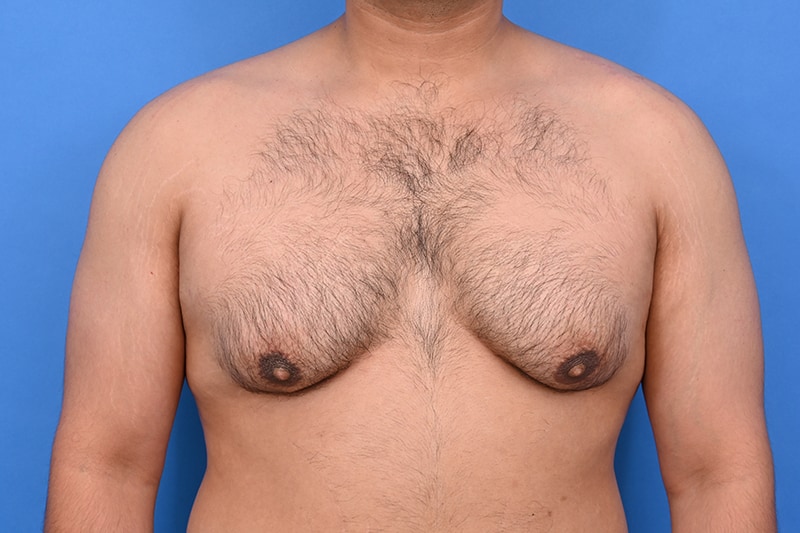 Patient Before & After Image