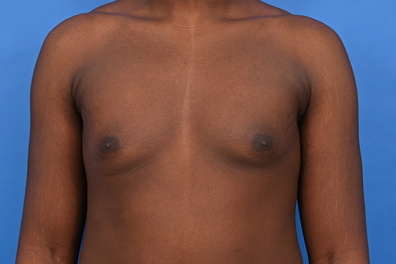 Patient Before & After Image