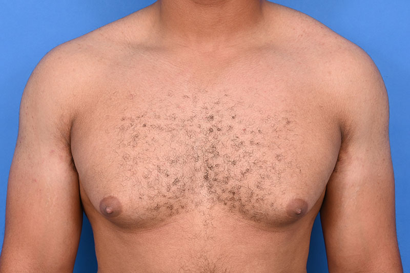 Patient Before & After Image