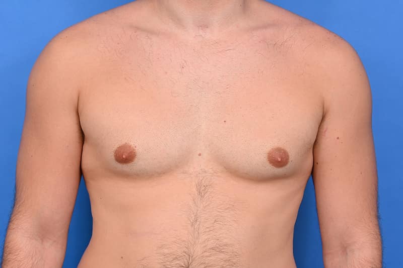 Patient Before & After Image