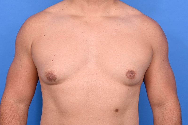 Patient Before & After Image