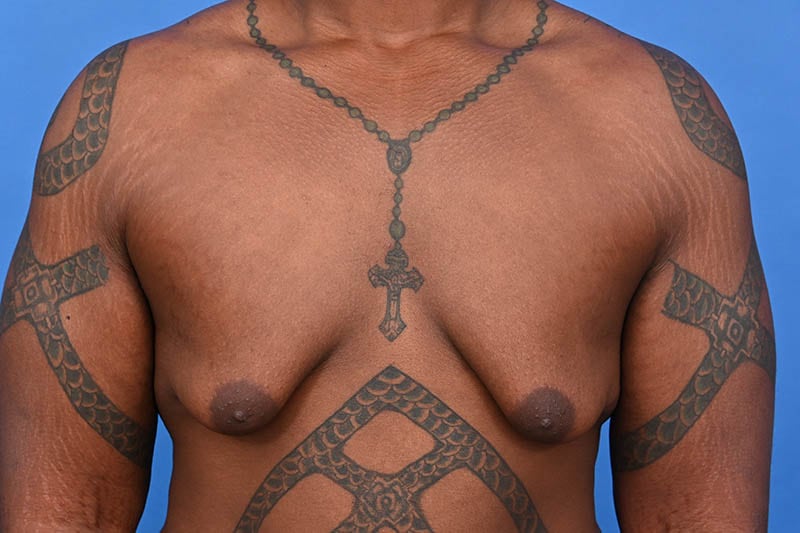 Patient Before & After Image