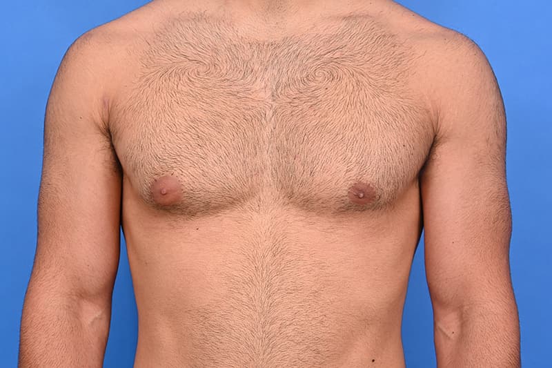 Patient Before & After Image