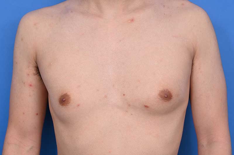 Patient Before & After Image