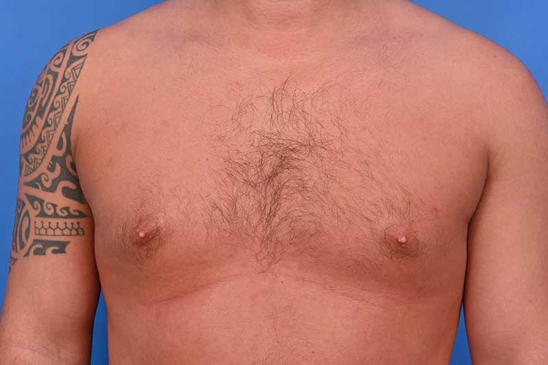 Patient Before & After Image