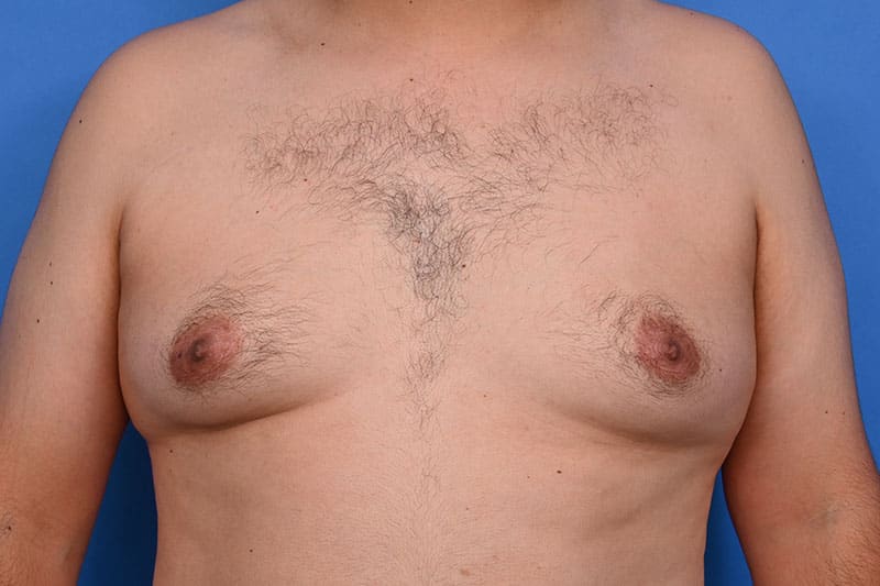 Patient Before & After Image