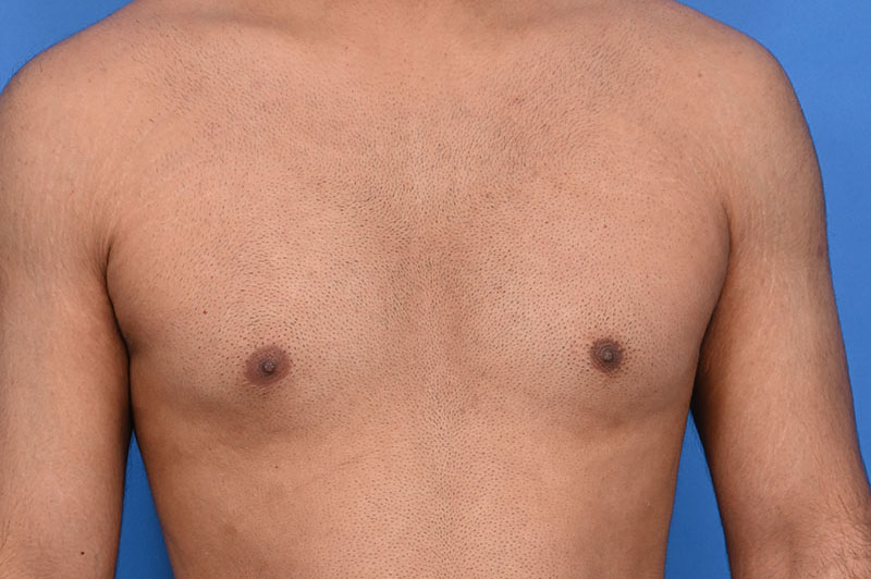 Patient Before & After Image