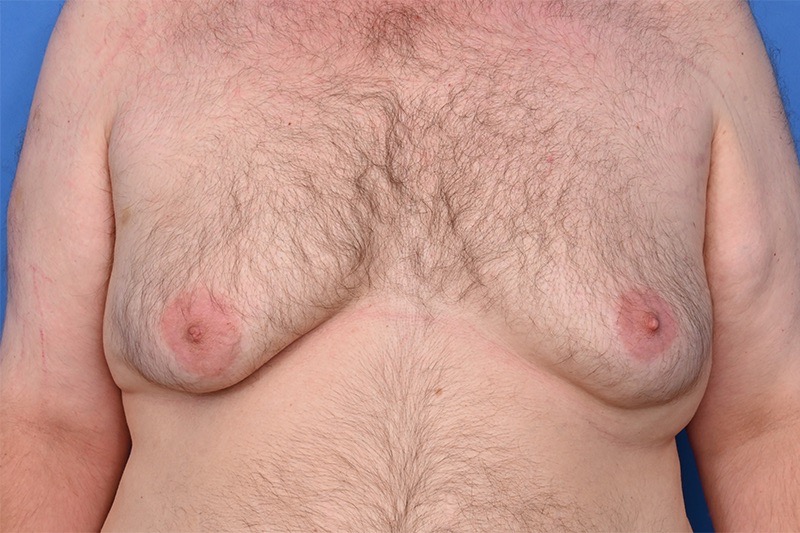 Patient Before & After Image