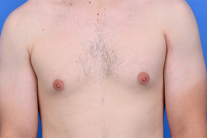 Patient Before & After Image