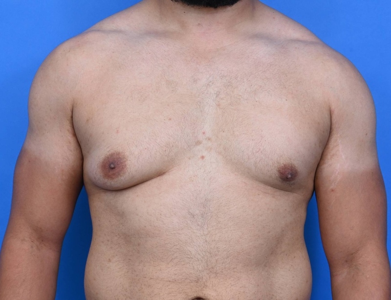 Patient Before & After Image