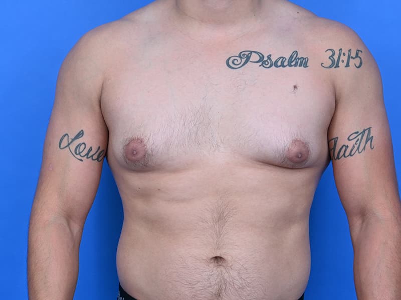 Patient Before & After Image