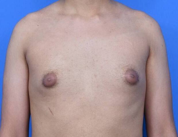 Patient Before & After Image