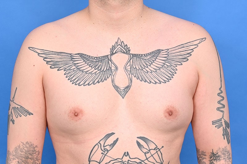 Patient Before & After Image