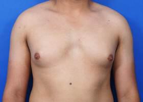 Patient Before & After Image