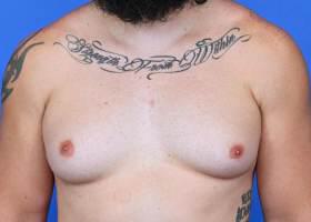 Patient Before & After Image